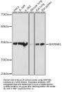 Leukocyte Elastase Inhibitor (SERPINB1) Antibody