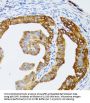 Chromatin Assembly Factor 1, Subunit B (CHAF1B) Antibody