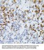 Chromatin Assembly Factor 1, Subunit B (CHAF1B) Antibody