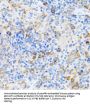 Chromatin Assembly Factor 1, Subunit B (CHAF1B) Antibody