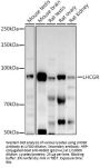 Luteinizing Hormone/Choriogonadotropin Receptor (LHCGR) Antibody