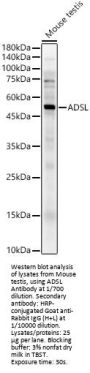 Adenylosuccinate Lyase (ADSL) Antibody