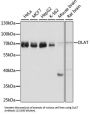 Dihydrolipoyl Transacetylase (DLAT) Antibody
