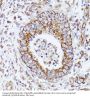 Dihydrolipoyl Transacetylase (DLAT) Antibody