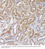 Dihydrolipoyl Transacetylase (DLAT) Antibody