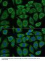 Dihydrolipoyl Transacetylase (DLAT) Antibody
