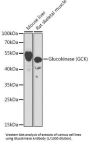 Hexokinase-4 (GCK) Antibody