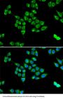 Plasma Anticoagulant Protein C (PC) Antibody