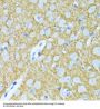 Synaptophysin (SYP) Antibody
