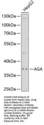 Aspartylglucosylamine Deaspartylase (AGA) Antibody