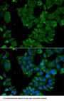 Drebrin (DBN1) Antibody