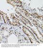 ETS-Related Transcription Factor Elf-3 (ELF3) Antibody