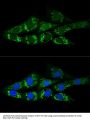 Acetyl-Coenzyme A Synthetase, Cytoplasmic (ACSS2) Antibody