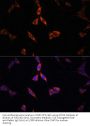 Acetyl-Coenzyme A Synthetase, Cytoplasmic (ACSS2) Antibody