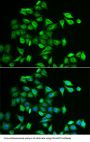 Chromosome 3 Open Reading Frame 39 (POMGNT2) Antibody