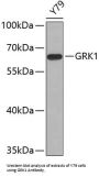Rhodopsin Kinase (GRK1) Antibody