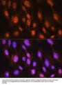 DNA Damage Inducible Transcript 3 (DDIT3) Antibody