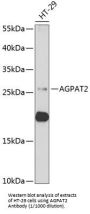 1-Acylglycerol-3-Phosphate O-Acyltransferase 2 (AGPAT2) Antibody