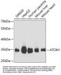 Protein Atonal Homolog 1 (ATOH1) Antibody