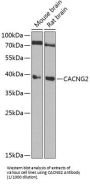 Voltage-Dependent Calcium Channel Gamma-2 Subunit (CACNG2) Antibody