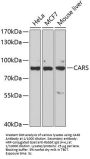 Cysteinyl-tRNA Synthetase 1 (CARS1) Antibody