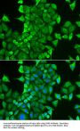 Cysteinyl-tRNA Synthetase 1 (CARS1) Antibody