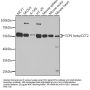 T-Complex Protein 1 Subunit Beta (CCT2) Antibody