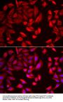 T-Complex Protein 1 Subunit Beta (CCT2) Antibody