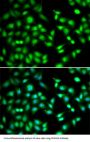 Cyclin Dependent Kinase Inhibitor 2D (CDKN2D) Antibody