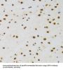 Cysteine And Glycine Rich Protein 3 (CSRP3) Antibody