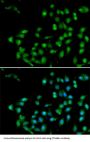 Beta-Catenin-Like Protein 1 (CTNNBL1) Antibody