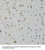ATP-Dependent RNA Helicase DDX1 (DDX1) Antibody