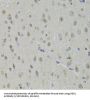 ATP-Dependent RNA Helicase DDX1 (DDX1) Antibody