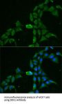 ATP-Dependent RNA Helicase DDX1 (DDX1) Antibody