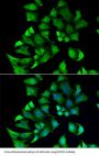 Ectonucleoside Triphosphate Diphosphohydrolase 2 (ENTPD2) Antibody
