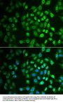 Fumarylacetoacetate Hydrolase (FAH) Antibody