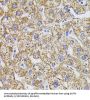 Glycine Amidinotransferase, Mitochondrial (GATM) Antibody