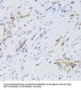 Glycine Amidinotransferase, Mitochondrial (GATM) Antibody