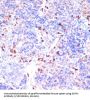 Glycine Amidinotransferase, Mitochondrial (GATM) Antibody
