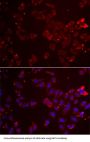 Glycine Amidinotransferase, Mitochondrial (GATM) Antibody