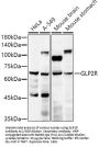Glucagon-Like Peptide 2 Receptor (GLP2R) Antibody