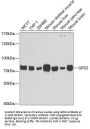 Glycerol-3-Phosphate Dehydrogenase 2 (GPD2) Antibody