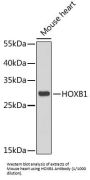 Homeobox Protein Hox-B1 (HOXB1) Antibody