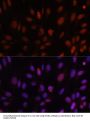 Homeobox Protein Hox-B1 (HOXB1) Antibody