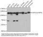 Heat Shock Protein 105 kDa (HSPH1) Antibody