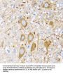 Heat Shock Protein 105 kDa (HSPH1) Antibody