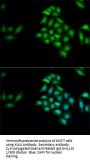 Kallikrein 4 (KLK4) Antibody