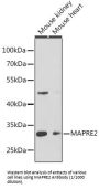 Microtubule Associated Protein RP/EB Family Member 2 (MAPRE2) Antibody