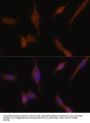 Melanophilin (MLPH) Antibody