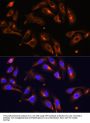Melanophilin (MLPH) Antibody